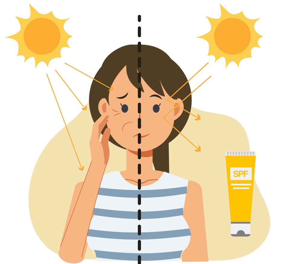 Sunscreen for Acne-Prone Skin